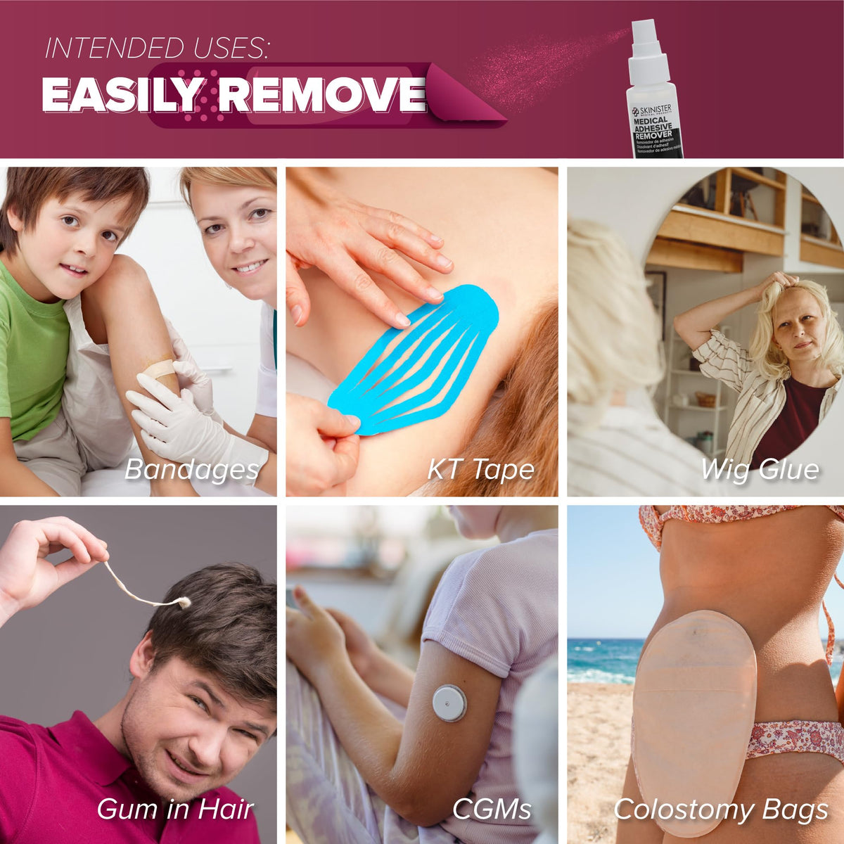 Adhesive Remover Wipes 50 Dry Wipes + 2oz Spray Solution B806